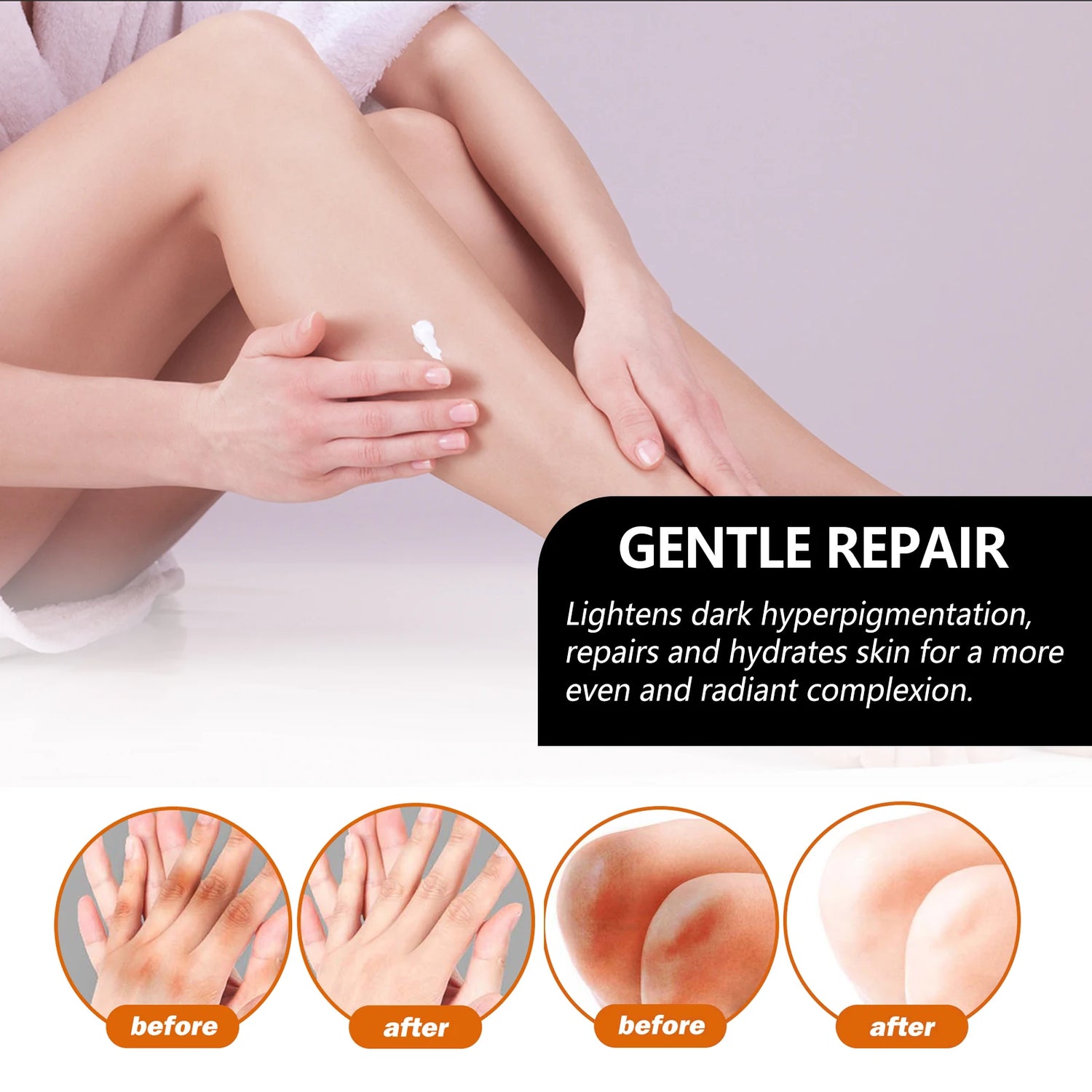 Person applying cream to leg with 'Gentle Repair' text and before-after skin improvement images.