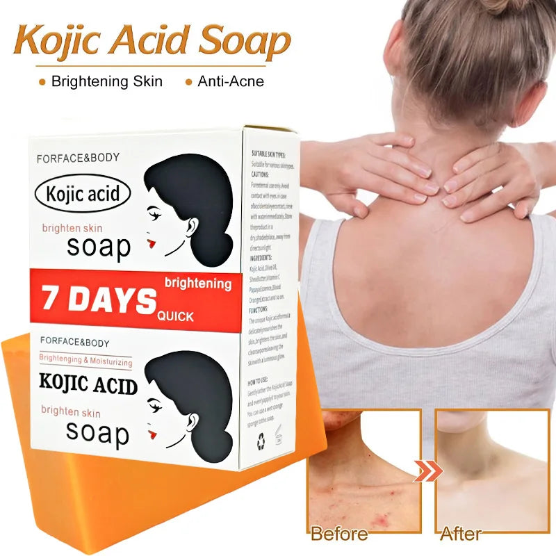 Kojic Acid Soap packaging with a woman applying soap to her back, showing before and after effects.