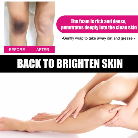 Before and after showing a person's legs with a dark spot, then smooth skin, with text about a skincare product.