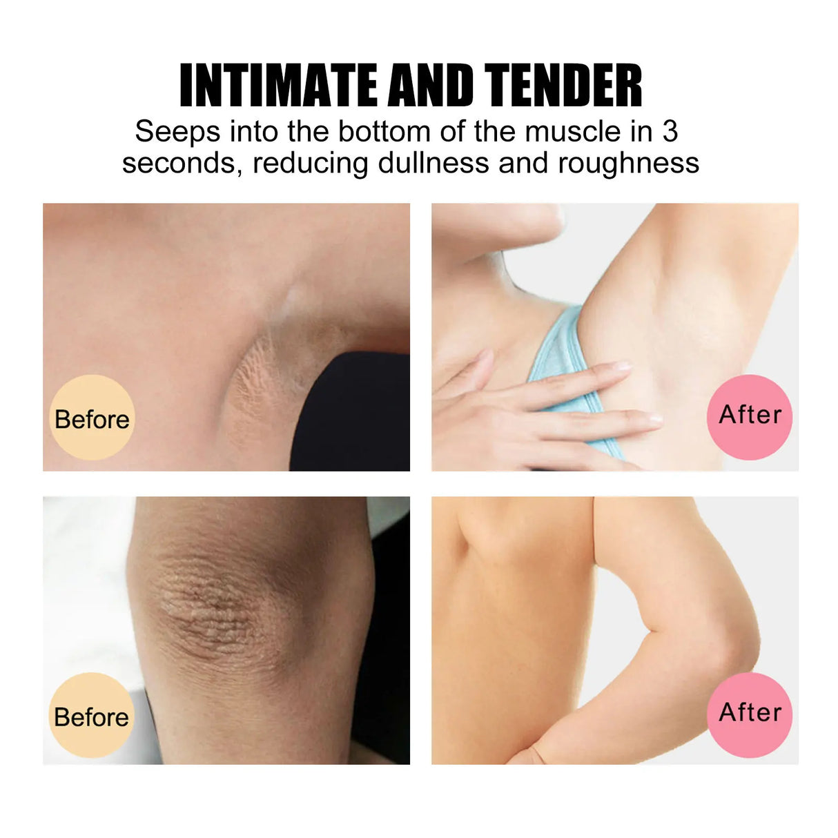 Before and after comparison of skin treatment on a person's leg with text indicating speed and effect.
