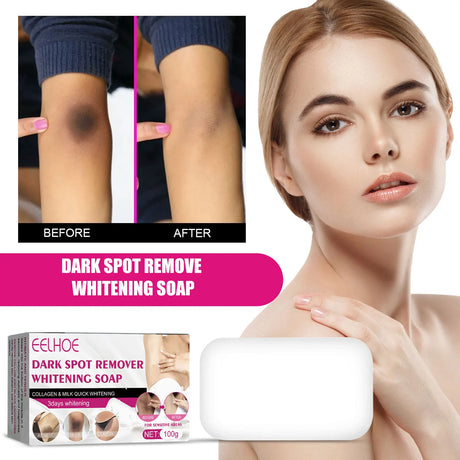 Dark spot remove whitening soap packaging with a woman's face and arms showing before and after effects.