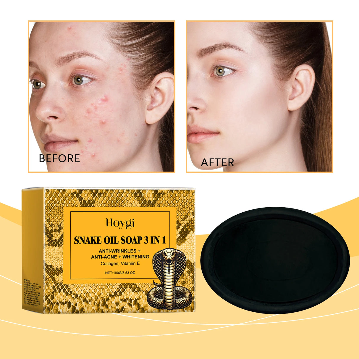 Snake oil soap packaging with 'Before' and 'After' skin comparison on a yellow background