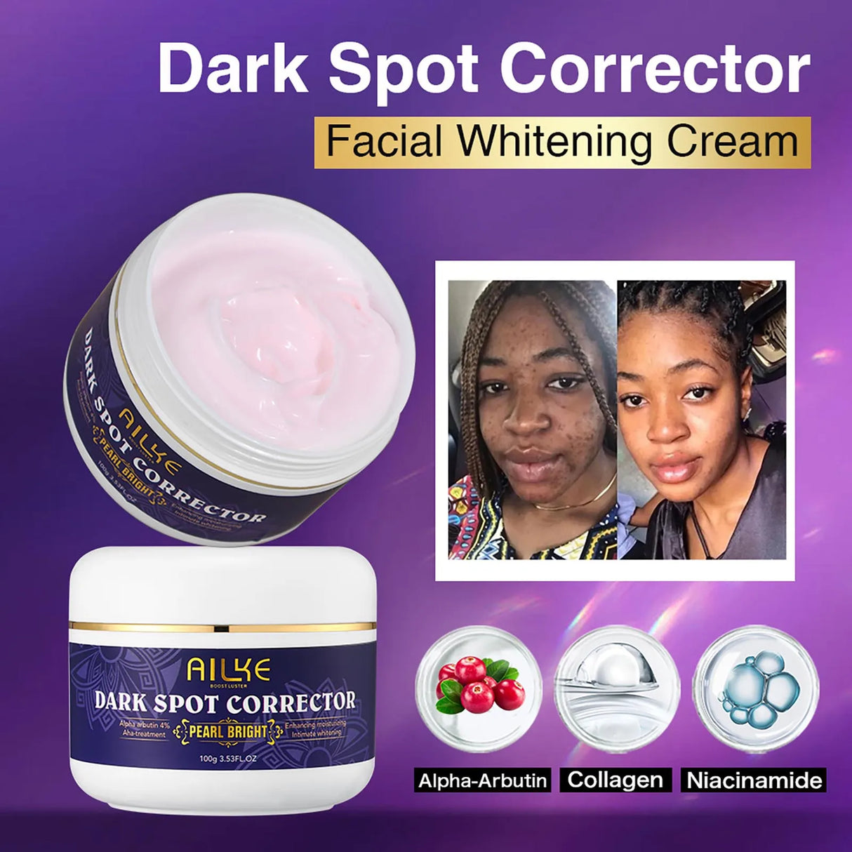 Ailye Dark Spot Corrector Facial Whitening Cream with before and after images on a purple background