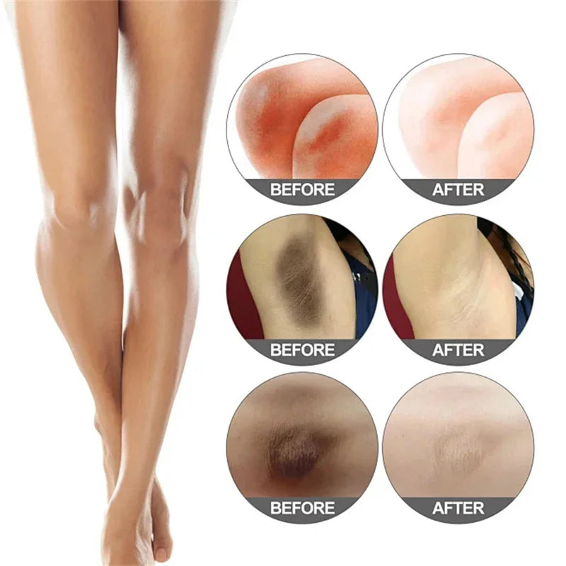 Before and after comparison of skin treatment on a person's leg.