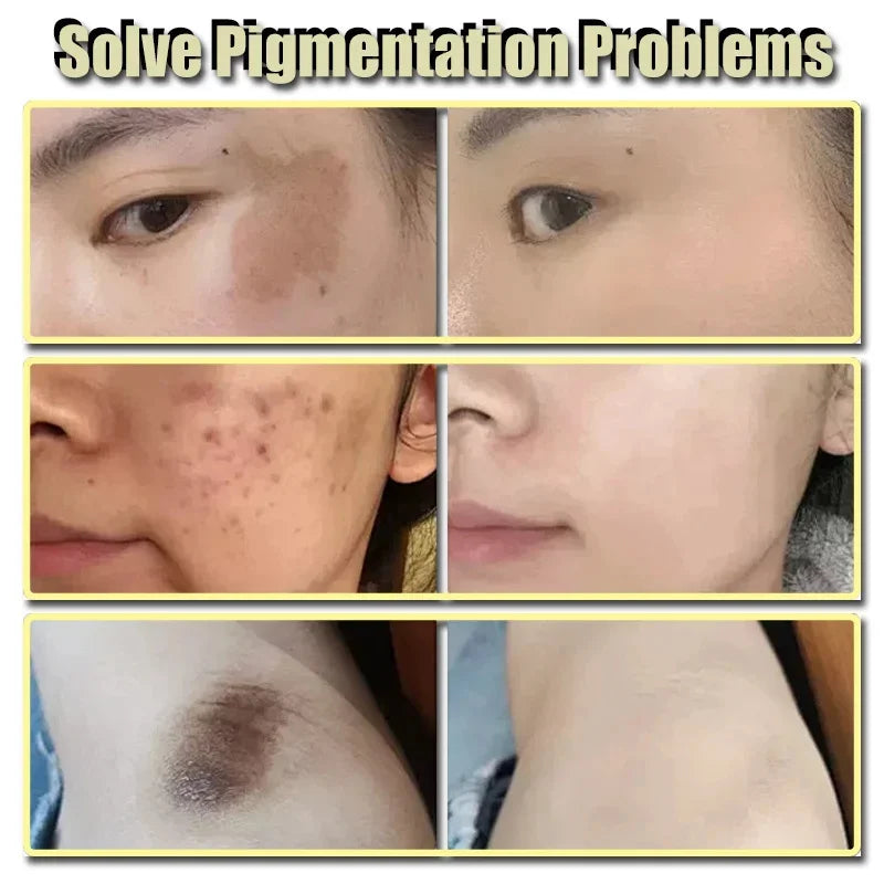 Before and after comparison of skin with pigmentation problems on a person's face and neck.