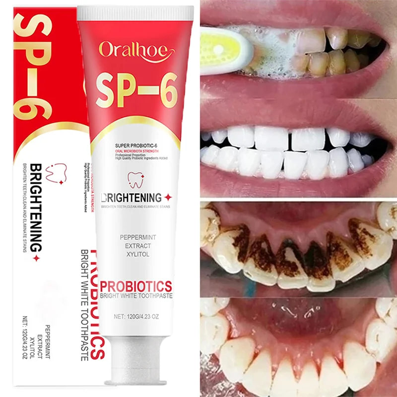 Oralhoo SP-6 Brightening toothpaste tube with before and after dental care images.