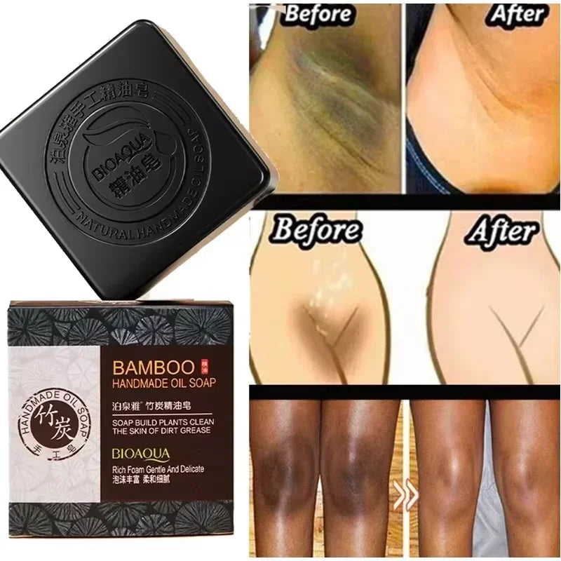 Black bamboo handmade oil soap with 'Before' and 'After' skin comparison images.