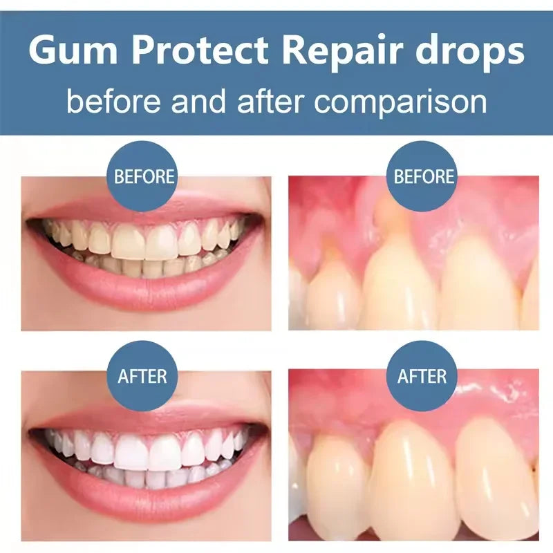Gum Protect Repair drops before and after comparison with a blue background