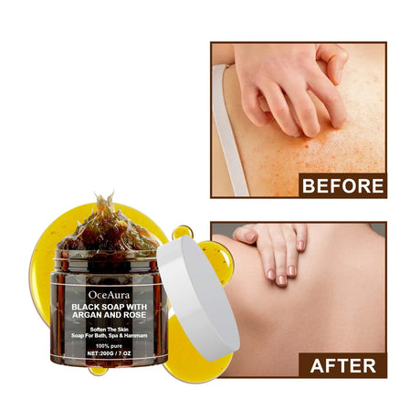 OceAura black soap with argan and rose packaging and before-and-after effects on skin.