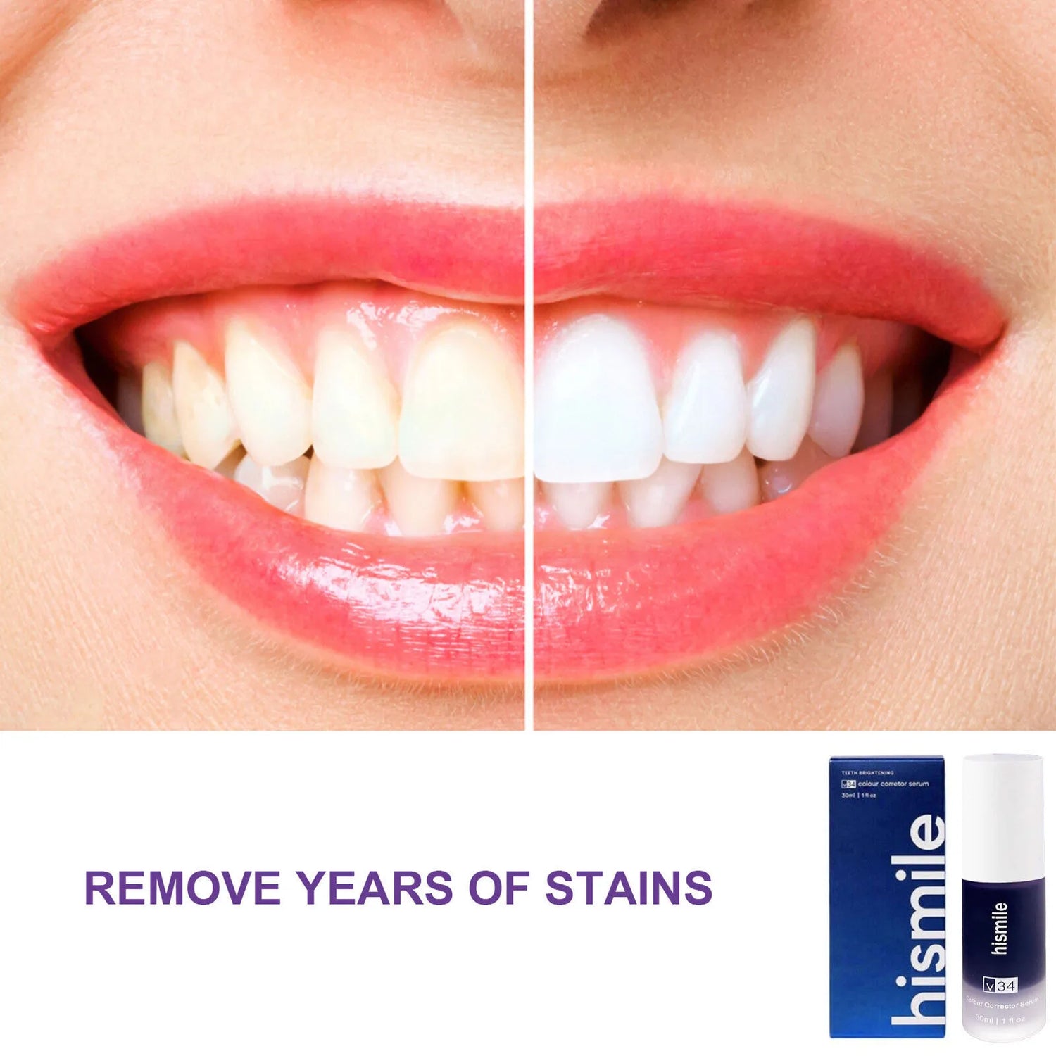 Before and after comparison of teeth with a 'hismile' product packaging.
