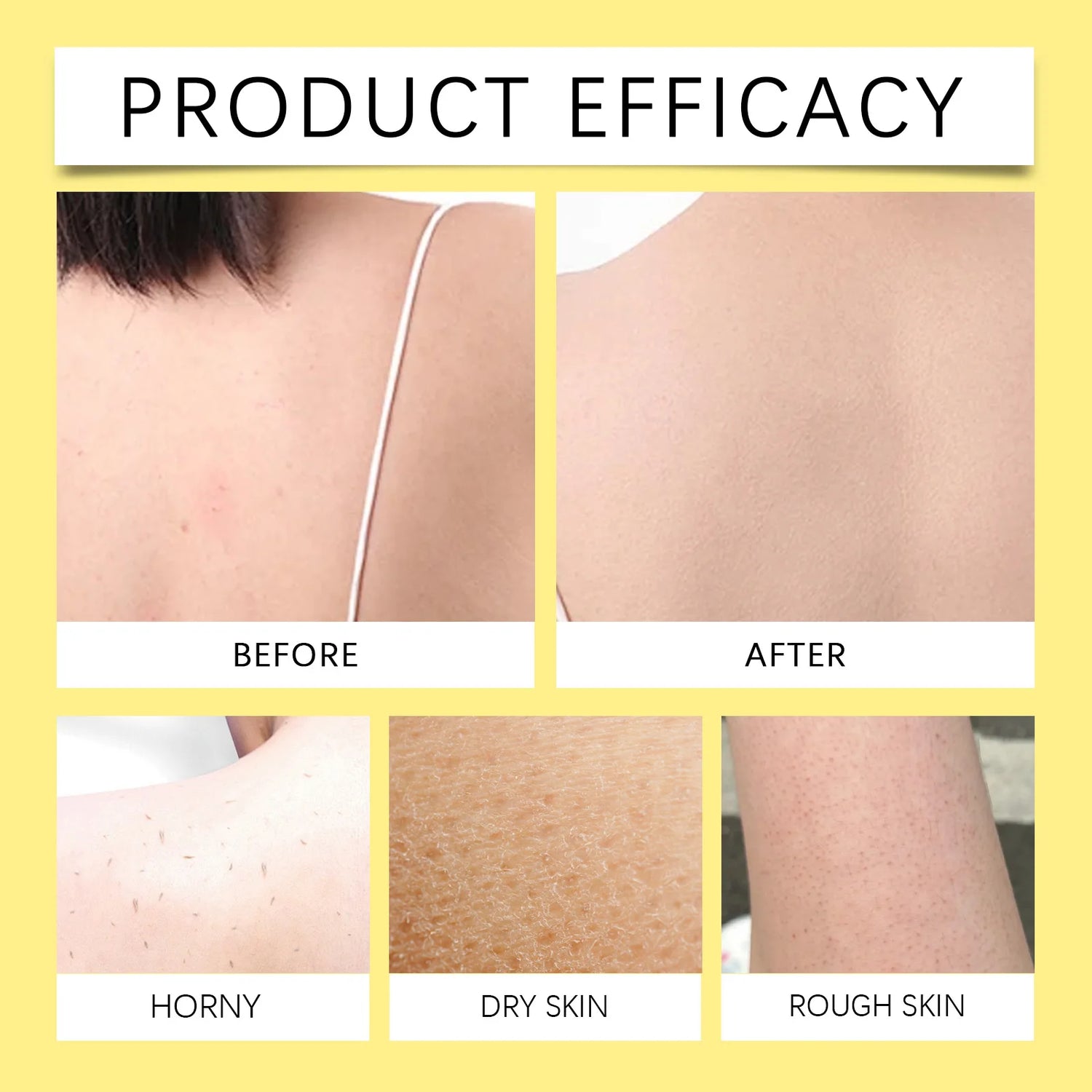 Before and after comparison of skin treatment on a person's shoulder with text 'Product Efficacy'.