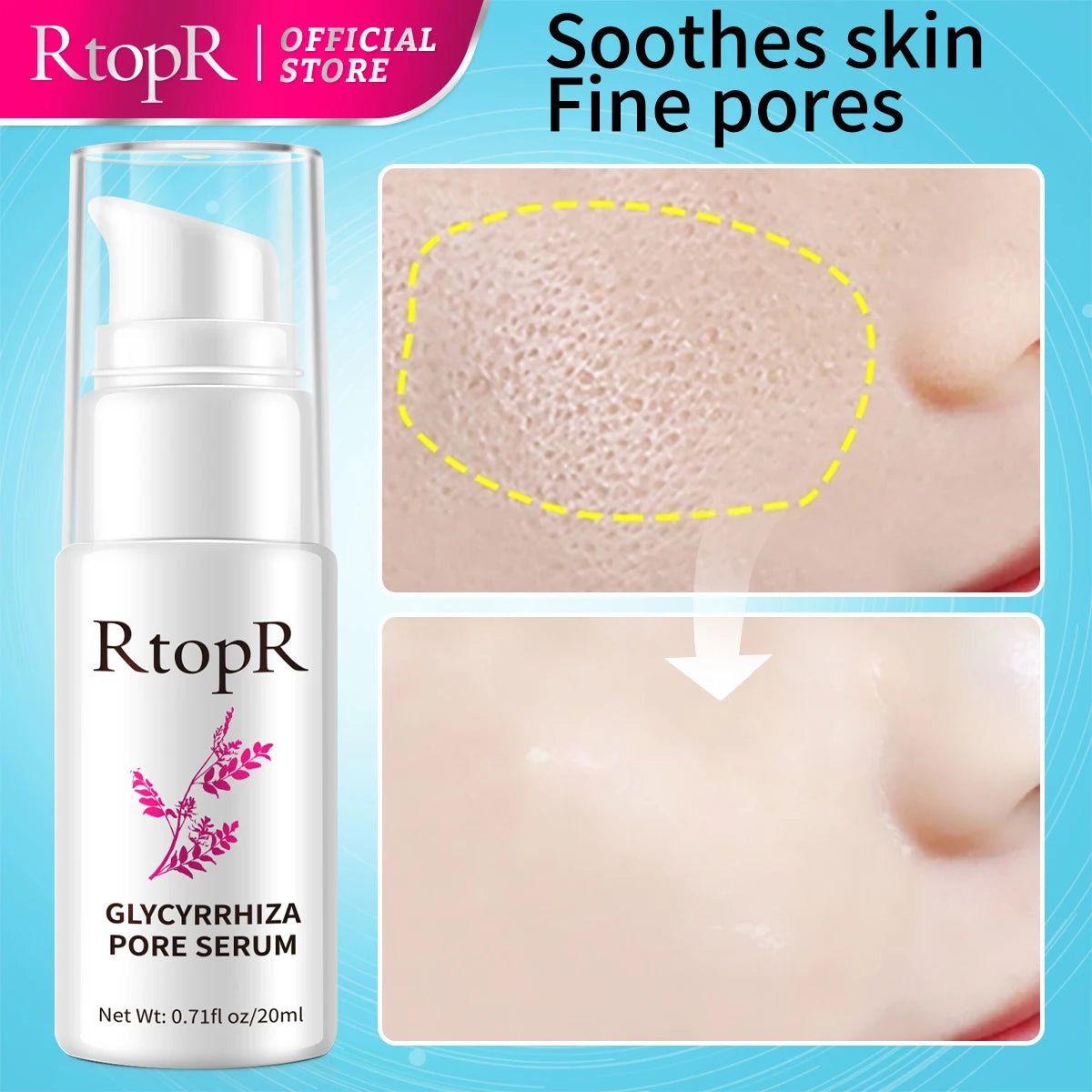 RtopR Glycyrrhiza Pore Serum with before and after skin texture on a blue background
