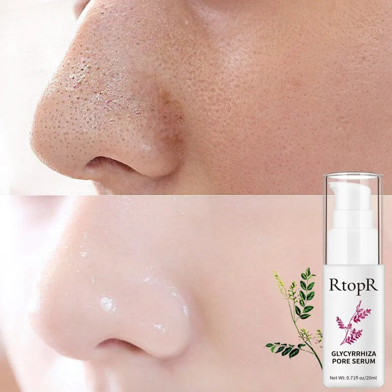 Close-up of a person's nose with a bottle of RtopR Glycyrrhiza Pore Serum in the corner.