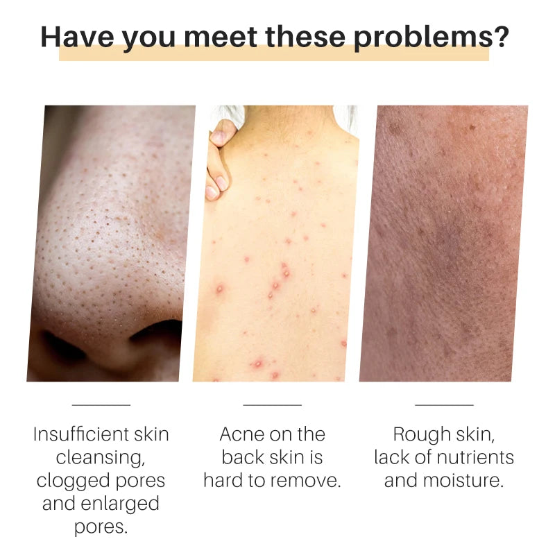 Three images of skin conditions with text describing common skin problems.