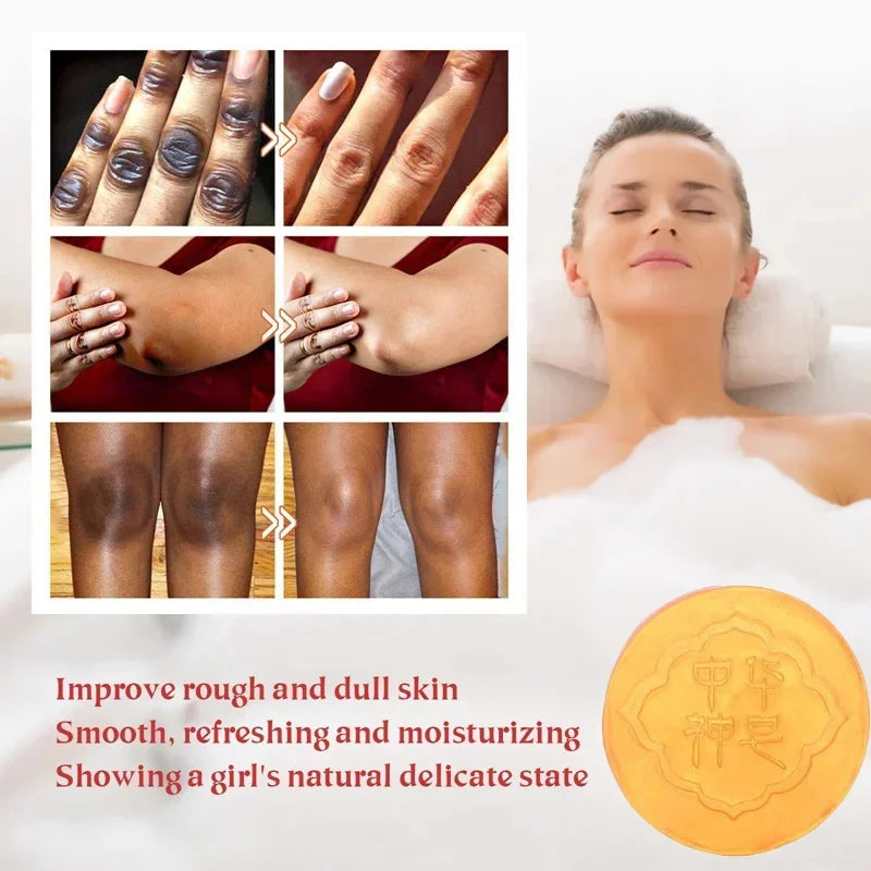 Soap advertisement with a woman and close-up of skin改善, featuring a yellow soap bar.