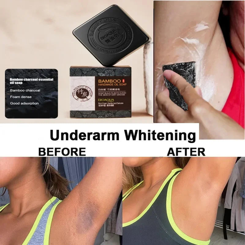 Before and after comparison of underarm whitening with a soap product.