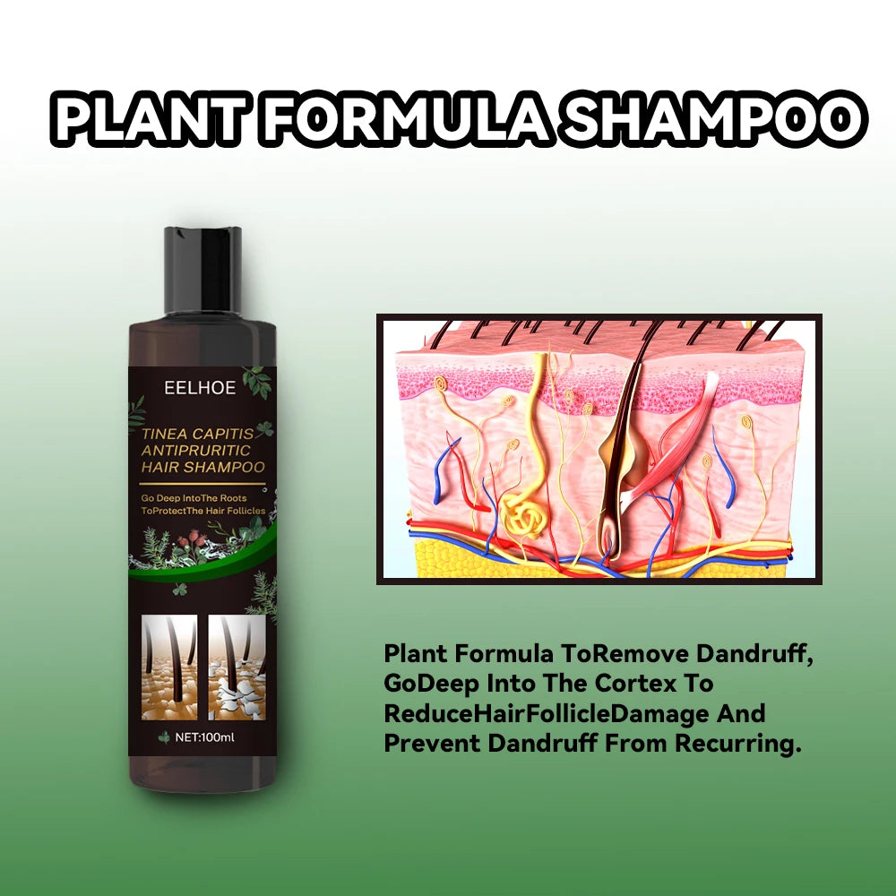 Eelhoe Natural Herbal Anti-Dandruff Shampoo plant formula with hair follicle diagram on green background.