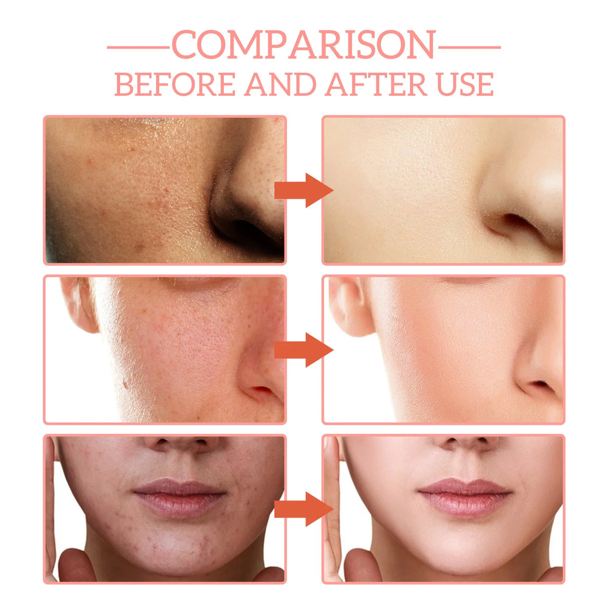 Hydrating face serum bottle for dry and sensitive skin to lock in moisture, soothe discomfort, and restore a healthy glow.