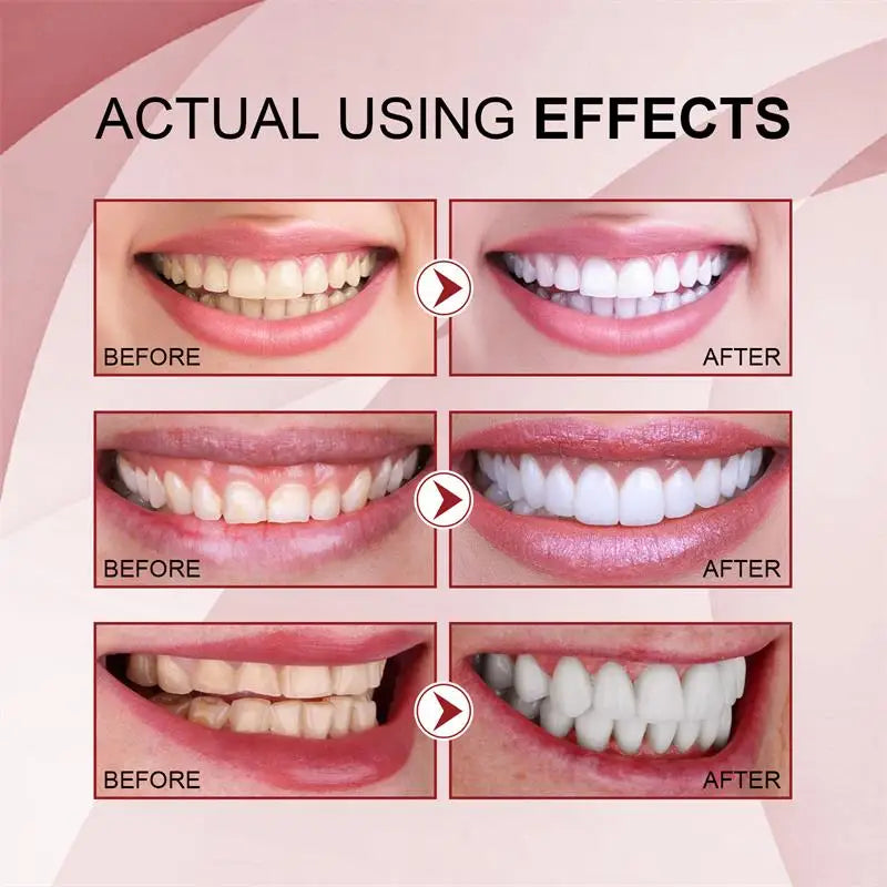 SP-6 Probiotic Whitening Toothpaste showing before and after whitening results on pink background.