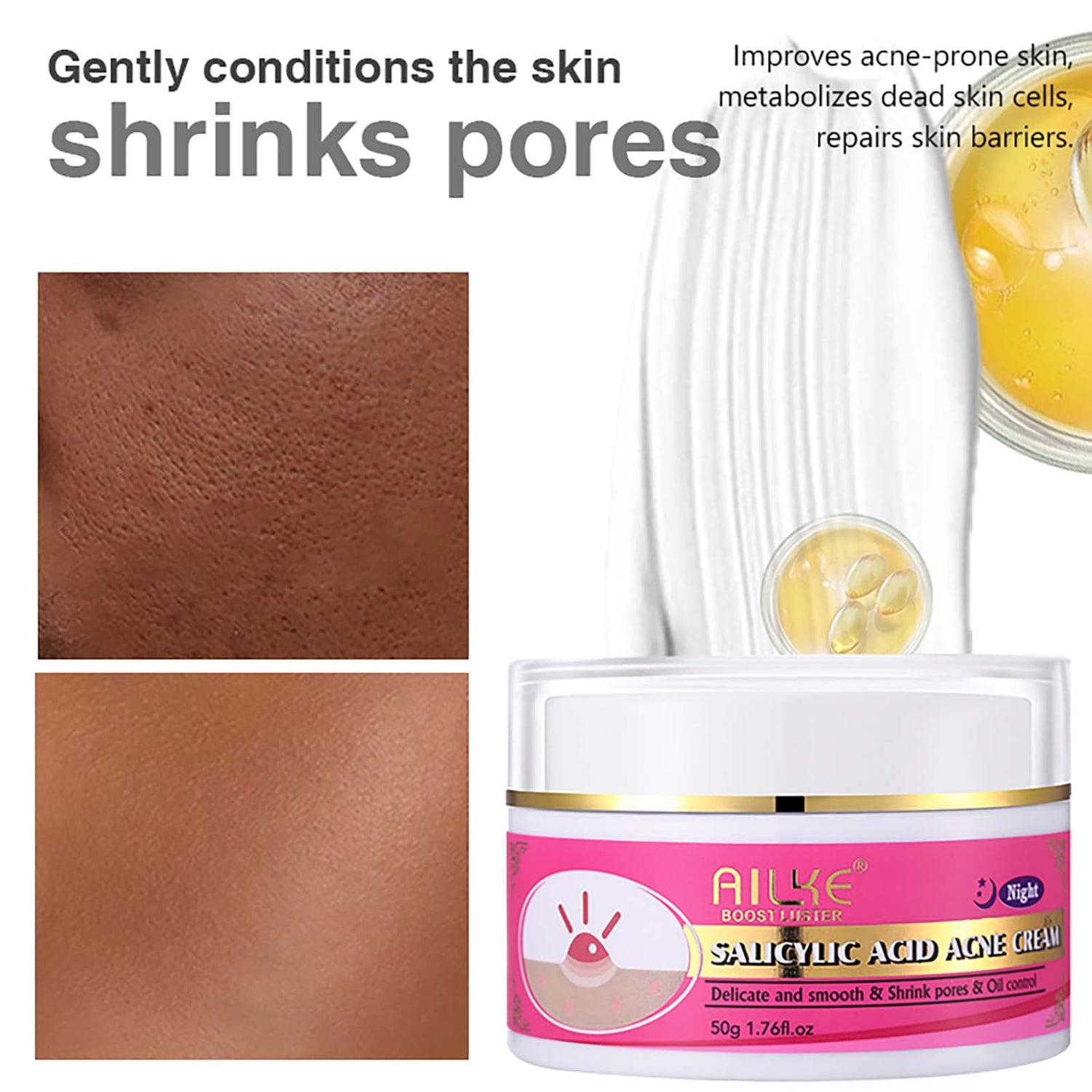 Organic Salicylic Acid Acne Cream