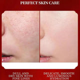 Before and after comparison of skin care treatment on a person's face with text 'Perfect Skin Care'.