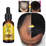 Bottle of 7 Days Eelhoe Germinal Oil with before and after hair growth comparison on a white background