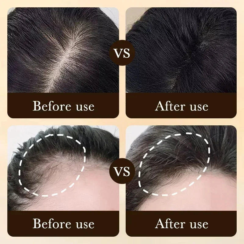 Before and after comparison of hair growth treatment on a beige background