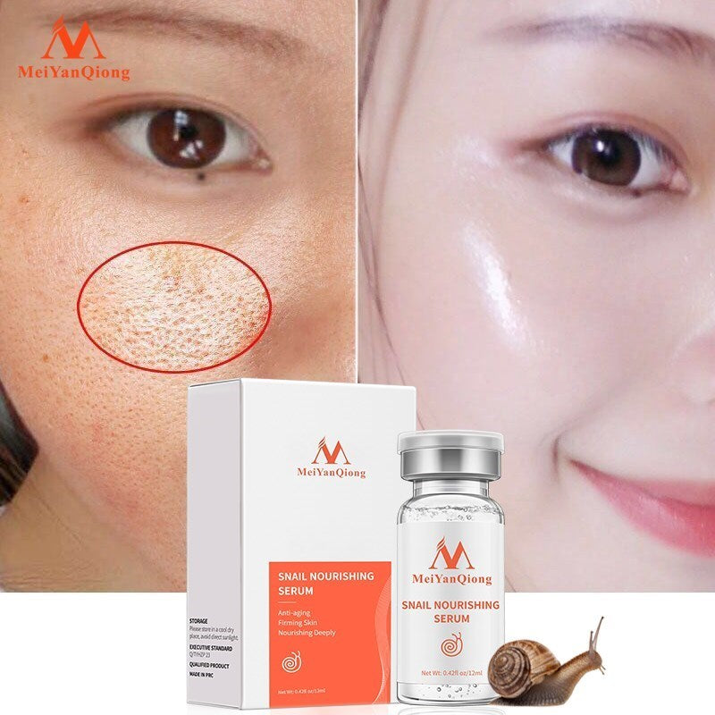 MeiYanQiong snail nourishing serum packaging with before and after effect on skin.