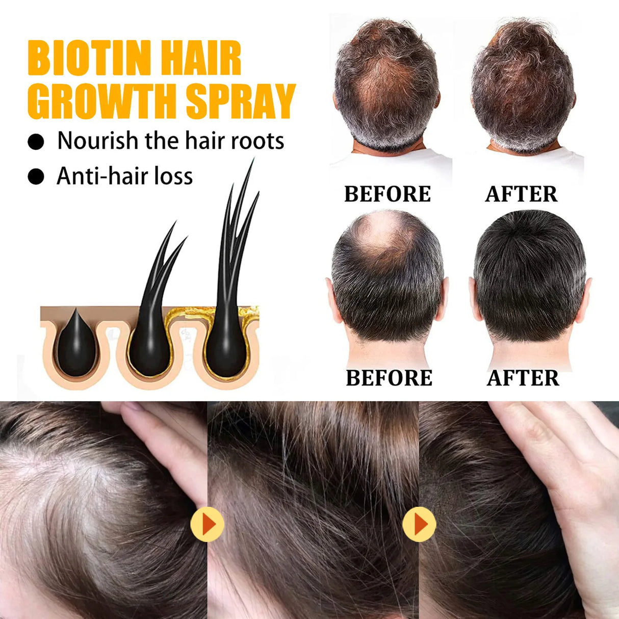 Advertisement for biotin hair growth spray showing before and after results.