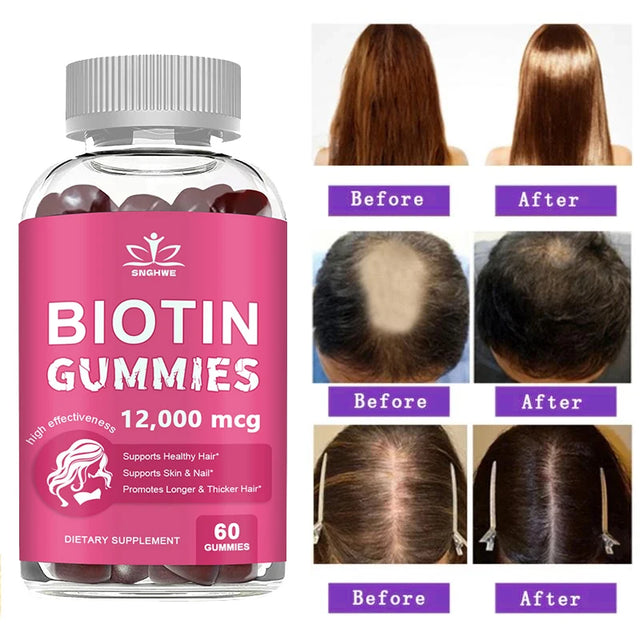 Bottle of biotin gummies with before and after hair health images on a white background