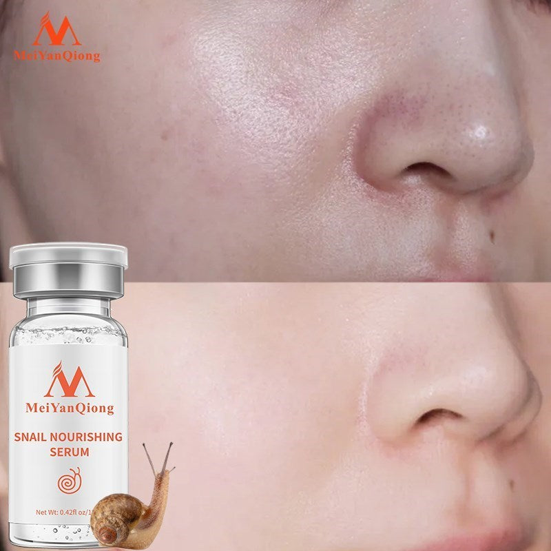Snail nourishing serum bottle with close-up of skin before and after application, Meiyanqiong brand visible.