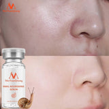 Snail nourishing serum bottle with close-up of skin before and after application, Meiyanqiong brand visible.