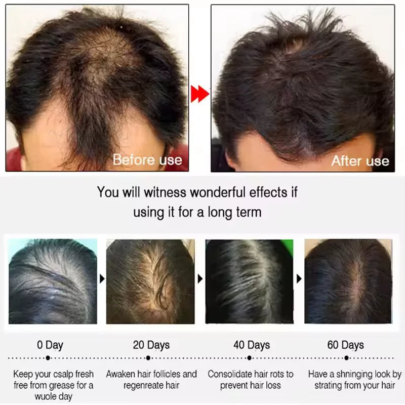 Before and after hair treatment results with labeled stages of hair growth.