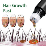 Hair growth product with illustrations of hair growth stages and a dropper applying a liquid.