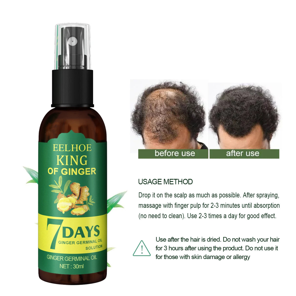 Bottle of Eelhoe King of Ginger 7 Days Ginger Germinal Oil with before and after usage on hair.