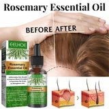 Rosemary essential oil bottle and packaging with 'before' and 'after' effects on hair.