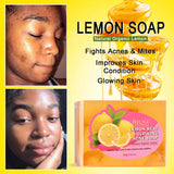 Advertisement for Alke Lemon Best Glowing Acne Soap with before and after effects on skin.