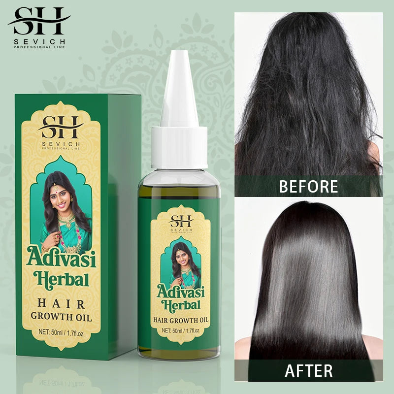 SH Sevich Adivasi Herbal Hair Growth Oil packaging and bottle with 'Before' and 'After' hair comparison on a green background.