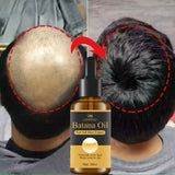 Bottle of Batana Oil with a split image showing before and after hair growth.