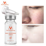 MeiYanQiong snail nourishing serum bottle with close-up images of skin before and after use.