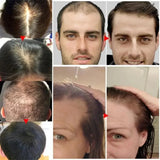 Collage of images showing hair health issues and a person with a bald head.