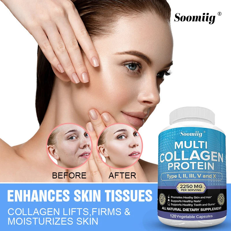 Advertisement for Soomiig Multi Collagen Protein supplement with a woman's face showing before and after effects.