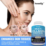 Advertisement for Soomiig Multi Collagen Protein supplement with a woman's face showing before and after effects.