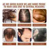 Infographic on hair loss causes with images and text.