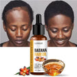 LEWEDO Batana Hair Oil bottle with a woman before and after using the product, and a bowl of oil.