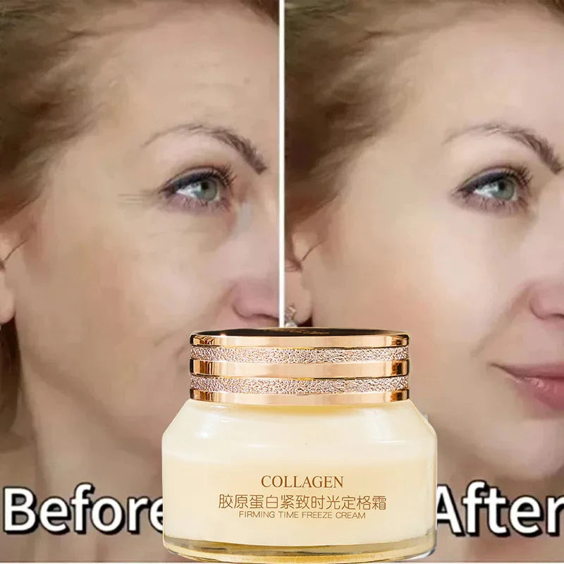 Collagen cream jar with 'Before' and 'After' effects on a woman's face.