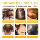 Promotional graphic about hair loss solutions with images of hair issues and text.