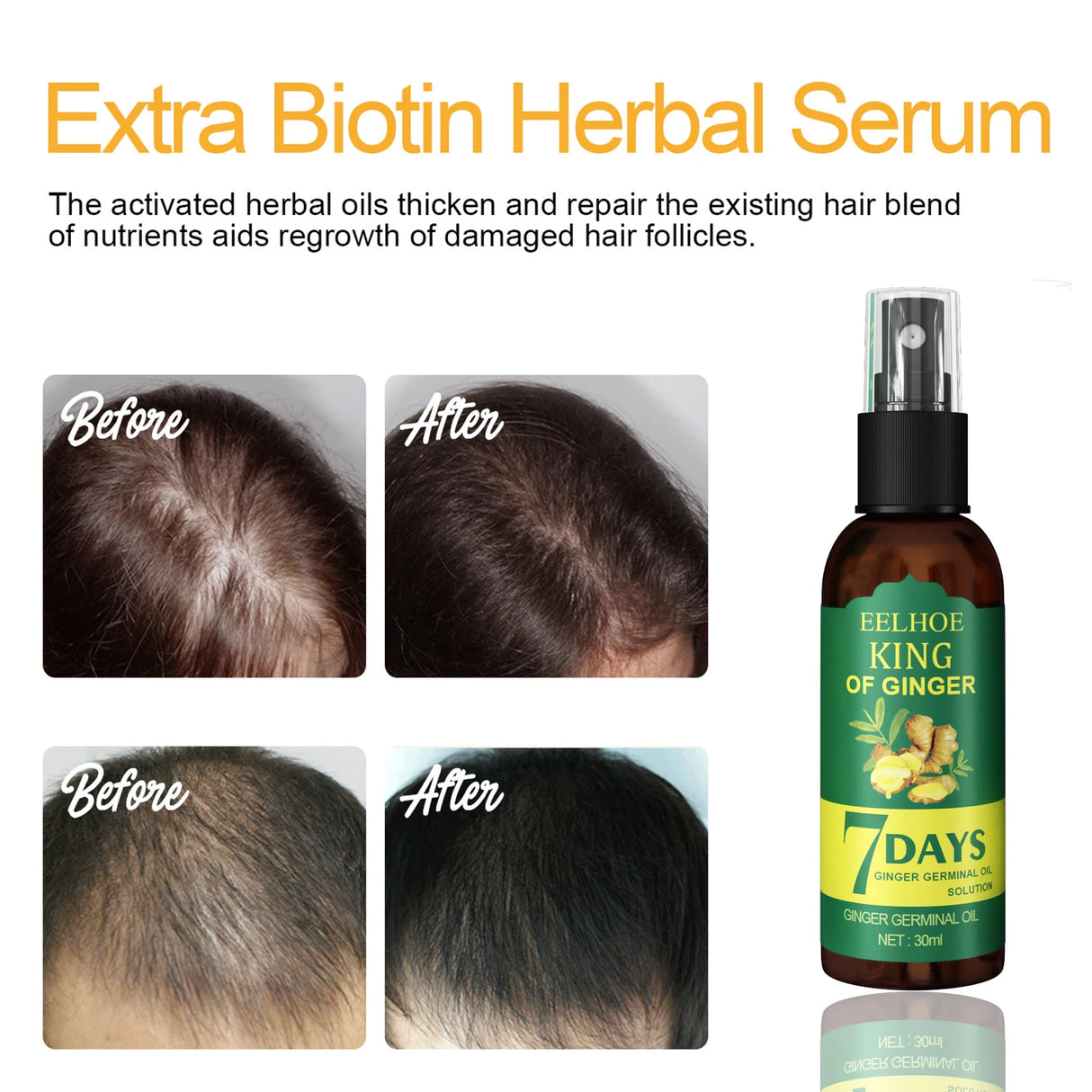 Extra Biotin Herbal Serum bottle with before and after hair growth images on a white background