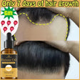 Hair oil bottle with a before-and-after comparison of hair growth, labeled 'Only 7 days of hair growth'.
