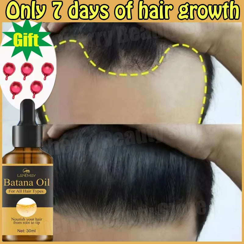 Hair oil bottle with a before-and-after comparison of hair growth, labeled 'Only 7 days of hair growth'.